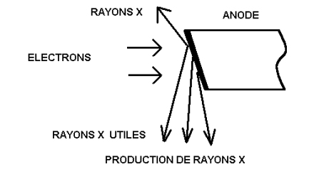 anode1